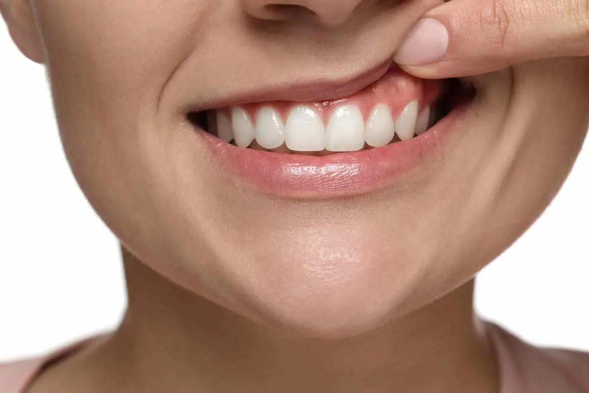 gummy smile treatment in Murfreesboro, TN