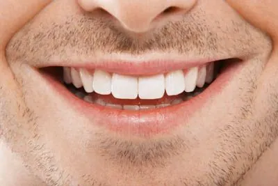 freshly cleaned smile at Gaither Perio and Dental Implants